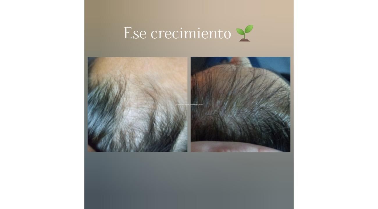¿Cuero cabelludo: sólo necesita shampoo?