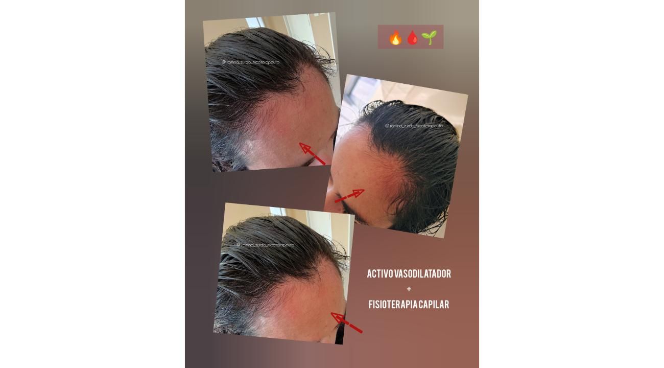 ¿Cuero cabelludo: sólo necesita shampoo?