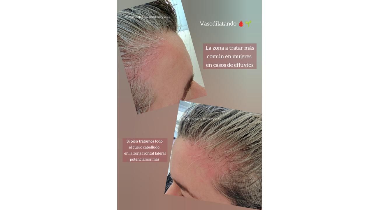 ¿Cuero cabelludo: sólo necesita shampoo?