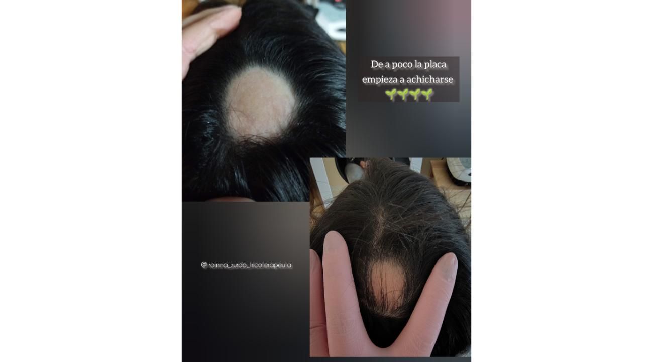 ¿Cuero cabelludo: sólo necesita shampoo?