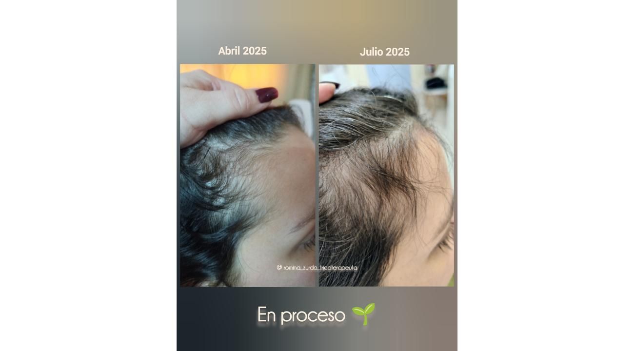 ¿Cuero cabelludo: sólo necesita shampoo?