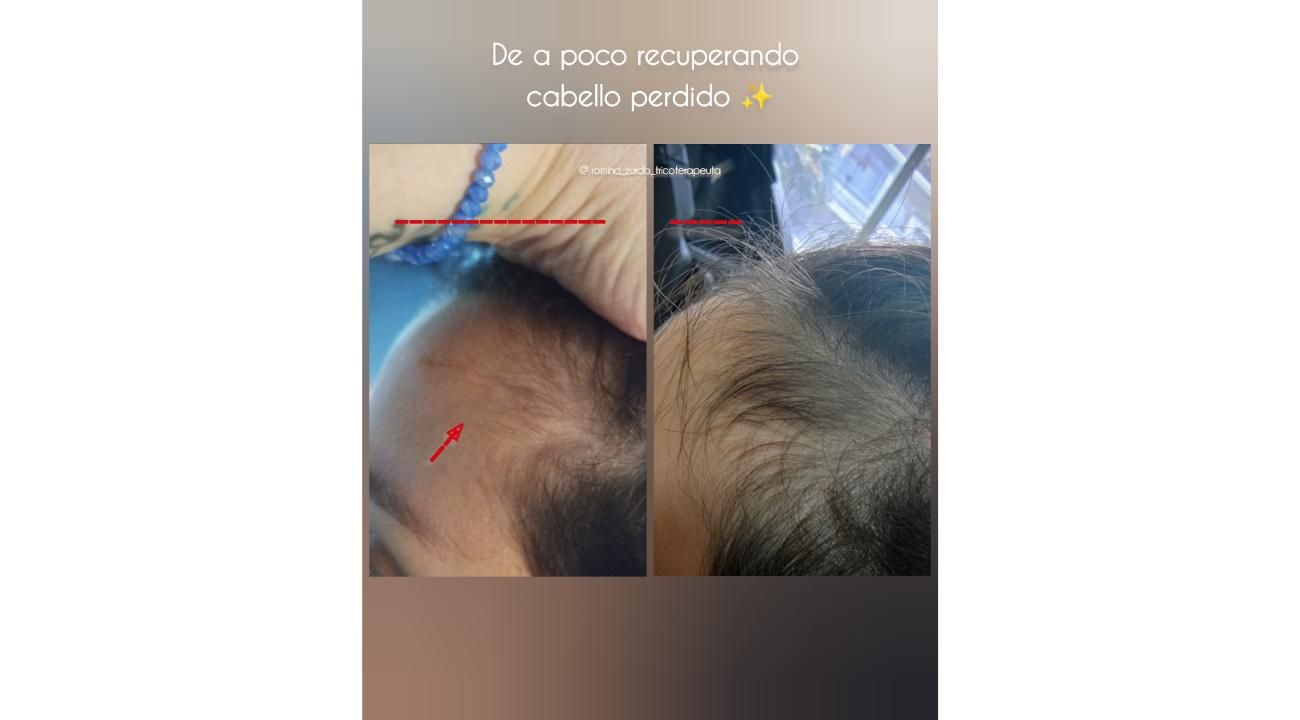 ¿Cuero cabelludo: sólo necesita shampoo?