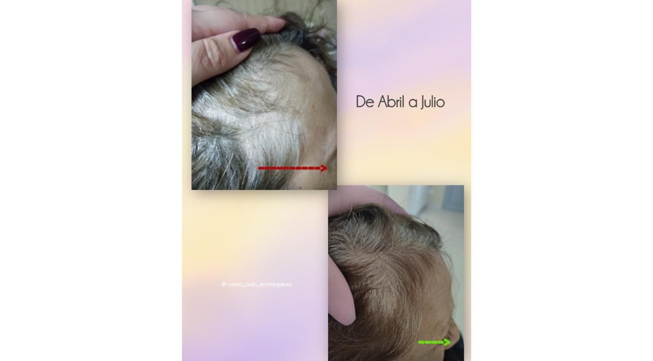 ¿Cuero cabelludo: sólo necesita shampoo?