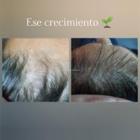 ¿Cuero cabelludo: sólo necesita shampoo?