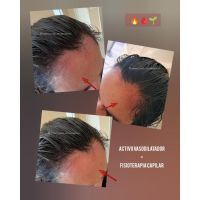 ¿Cuero cabelludo: sólo necesita shampoo?