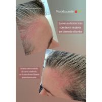 ¿Cuero cabelludo: sólo necesita shampoo?