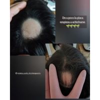 ¿Cuero cabelludo: sólo necesita shampoo?