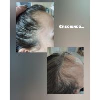 ¿Cuero cabelludo: sólo necesita shampoo?