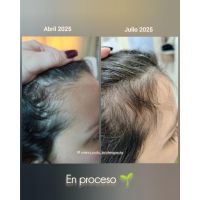 ¿Cuero cabelludo: sólo necesita shampoo?
