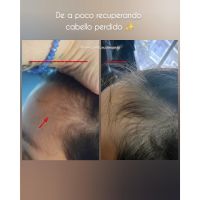 ¿Cuero cabelludo: sólo necesita shampoo?