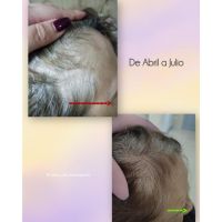 ¿Cuero cabelludo: sólo necesita shampoo?