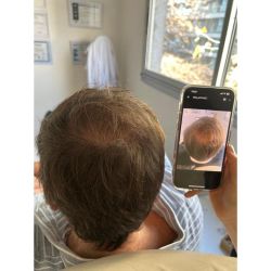 Regenerar, revitalizar, rejuvenecer: PRP y Mesoterapia en ME Por ME Medicina Evolutiva | Foto:CONTENT NOTICIAS