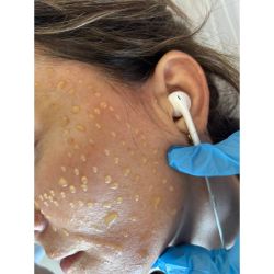 Regenerar, revitalizar, rejuvenecer: PRP y Mesoterapia en ME Por ME Medicina Evolutiva | Foto:CONTENT NOTICIAS