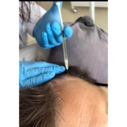 Regenerar, revitalizar, rejuvenecer: PRP y Mesoterapia en ME Por ME Medicina Evolutiva | Foto:CONTENT NOTICIAS