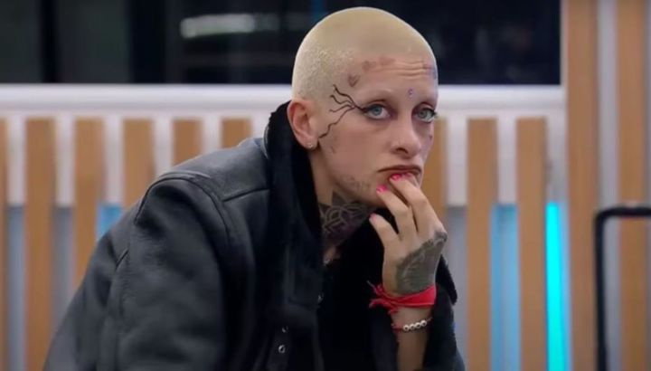 Furia Scaglione se realizó un nuevo retoque estético y reveló con un video el resultado