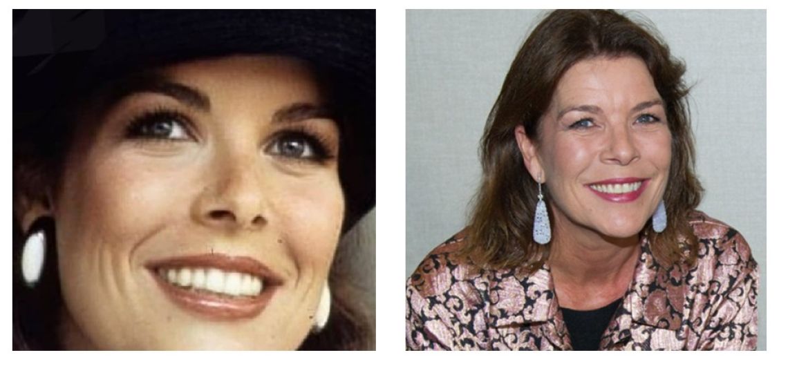 Carolina de Mónaco a sus 68 superó la calvicie y elevó su estilo con resiliencia e inspiración 