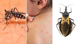 Mal de chagas 20082025