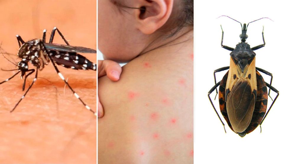 Mal de chagas 20082025