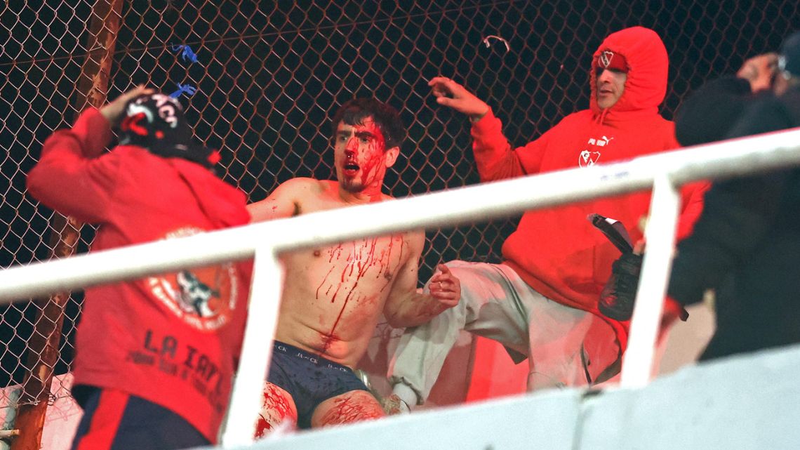 A fan of Universidad de Chile bleeds while being hit by fans of Independiente during the interruption of the Copa Sudamericana round of 16 second leg football match between Argentina's Independiente and Chile's Universidad de Chile at the Libertadores de America stadium in Avellaneda, Buenos Aires province, Argentina, on August 20, 2025. 