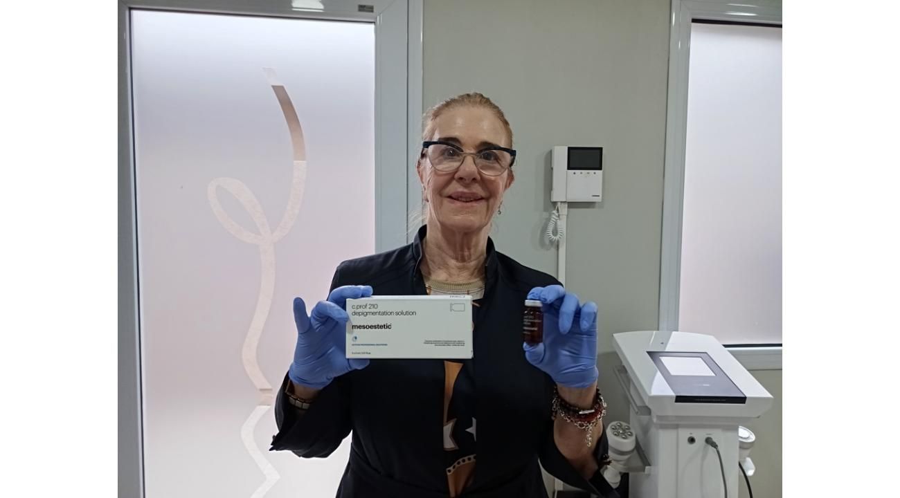 Melasma, el desafio dermatológico de la Hiperpigmentacion