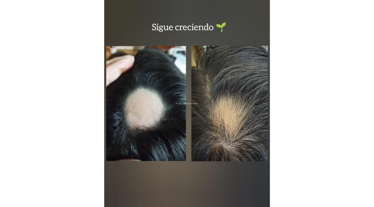 “Cuando las emociones se reflejan en tu cabello”