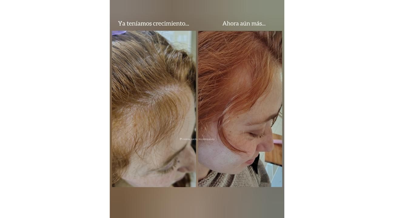 “Cuando las emociones se reflejan en tu cabello”