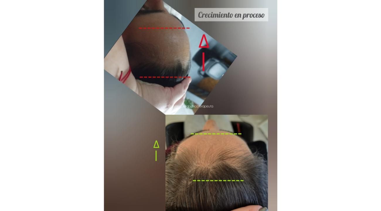 “Cuando las emociones se reflejan en tu cabello”