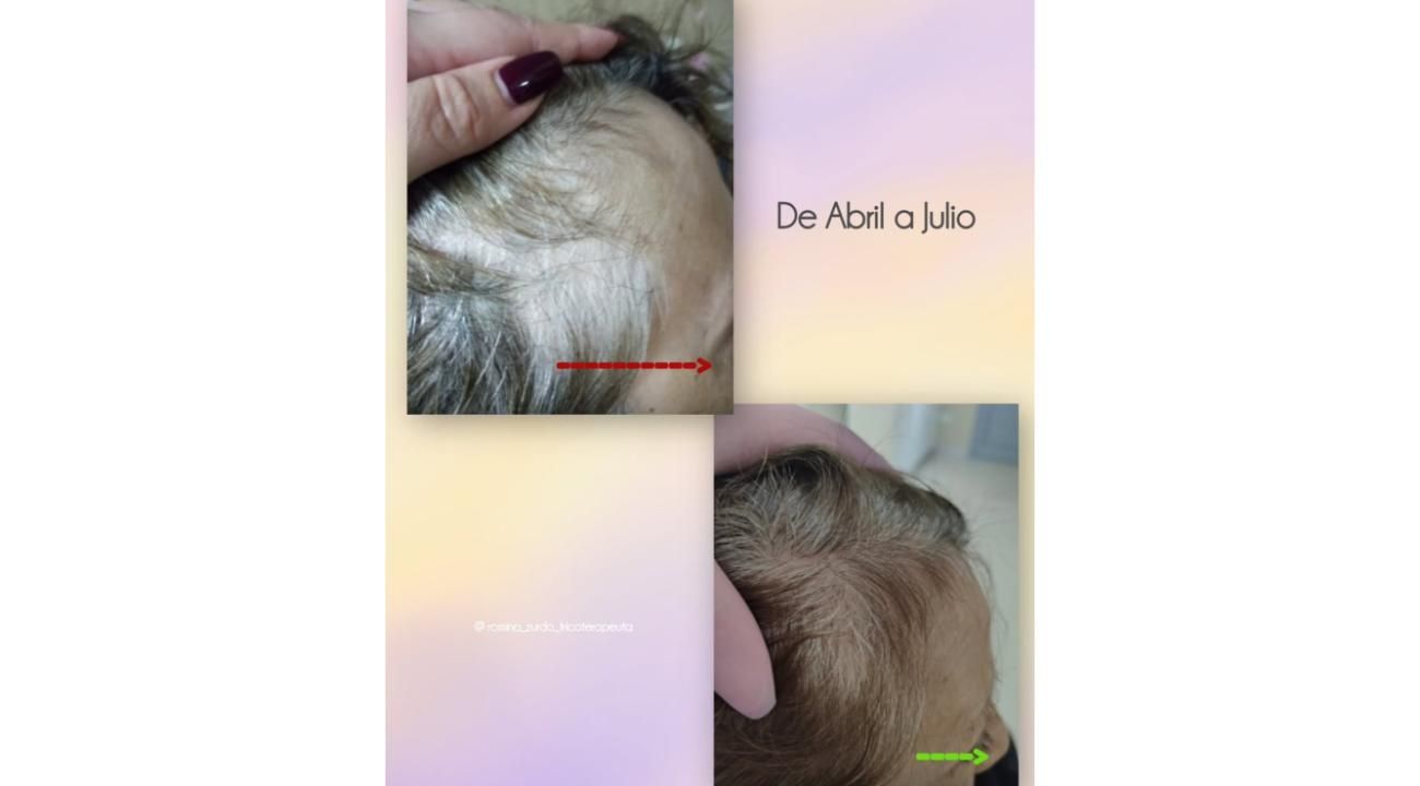 “Cuando las emociones se reflejan en tu cabello”