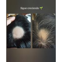 “Cuando las emociones se reflejan en tu cabello”