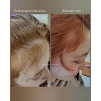 “Cuando las emociones se reflejan en tu cabello”