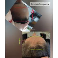 “Cuando las emociones se reflejan en tu cabello”
