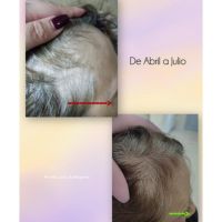 “Cuando las emociones se reflejan en tu cabello”