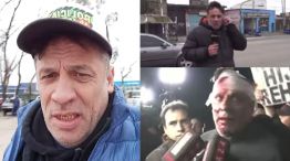 Periodista herido Cristian Mercatante 03092025