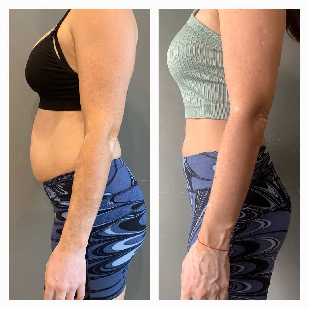Proyecto Abdomen