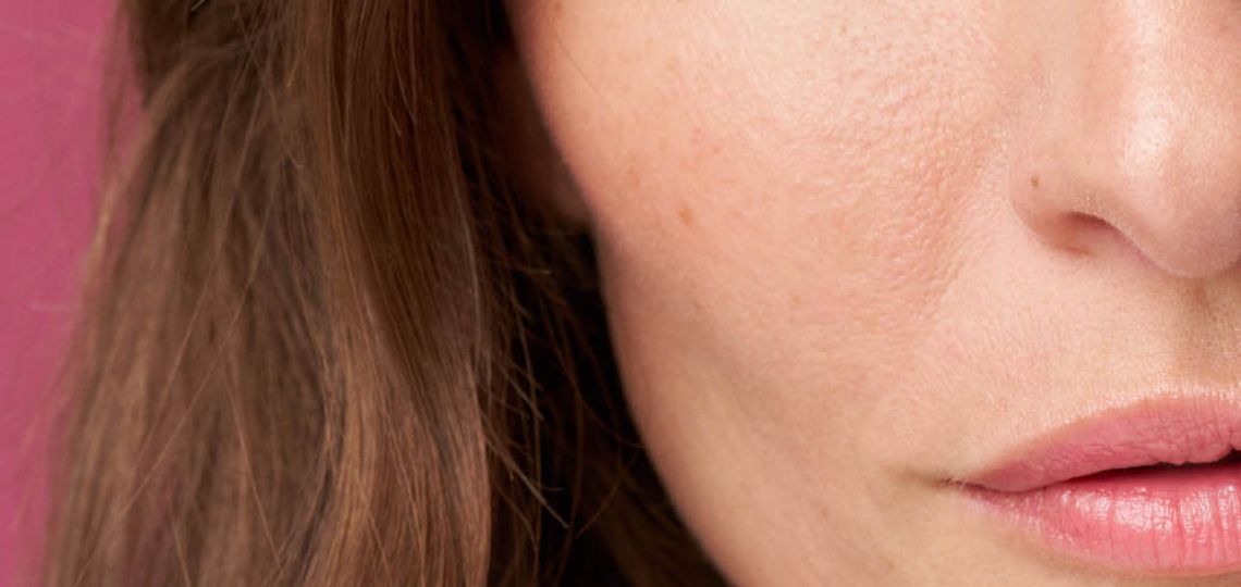 Ácidos en primavera: cómo usarlos (incluso si tenés piel sensible)