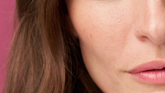 Ácidos en primavera: cómo usarlos (incluso si tenés piel sensible)