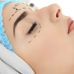 Cirugía estética | Foto:CEDOC