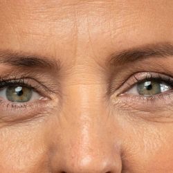 Un buen corrector puede transformar la mirada: la clave está en elegir el tono y la textura adecuados para tu tipo de ojera.