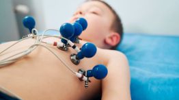 electrocardiograma-cus