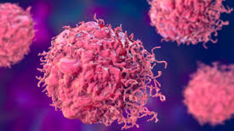 Cada vez más casos de cáncer en menores de 50 años.