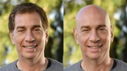 Diego Santilli pidió opiniones en redes sociales para decidir si se rapa o no