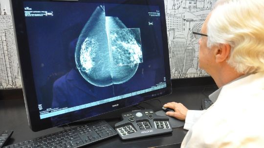 Impulsan que las mujeres se hagan mamografías a partir de cumplir sus cuarenta años
