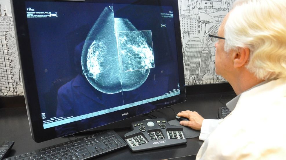 Impulsan que las mujeres se hagan mamografías a partir de cumplir sus cuarenta años