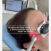 Láser en Odontología, el futuro es hoy