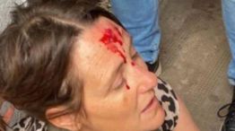 La Plata: una preceptora intentó frenar una pelea y terminó sangrando 05112025