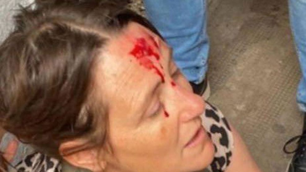 La Plata: una preceptora intentó frenar una pelea y terminó sangrando 05112025