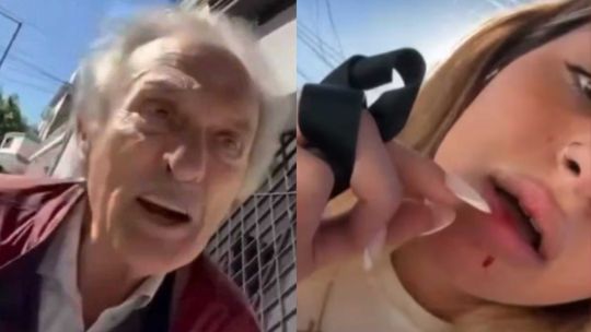 “Me pegó una piña con la llave”: un jubilado atacó a una joven por estacionar cerca de la salida de su garage