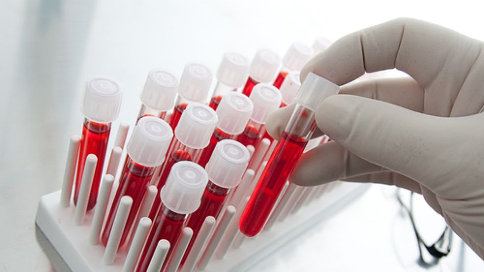 Un análisis de sangre podría detectar la demencia. 