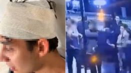 21-11-2025 joven mendocino golpeado por rugbiers cordobeses