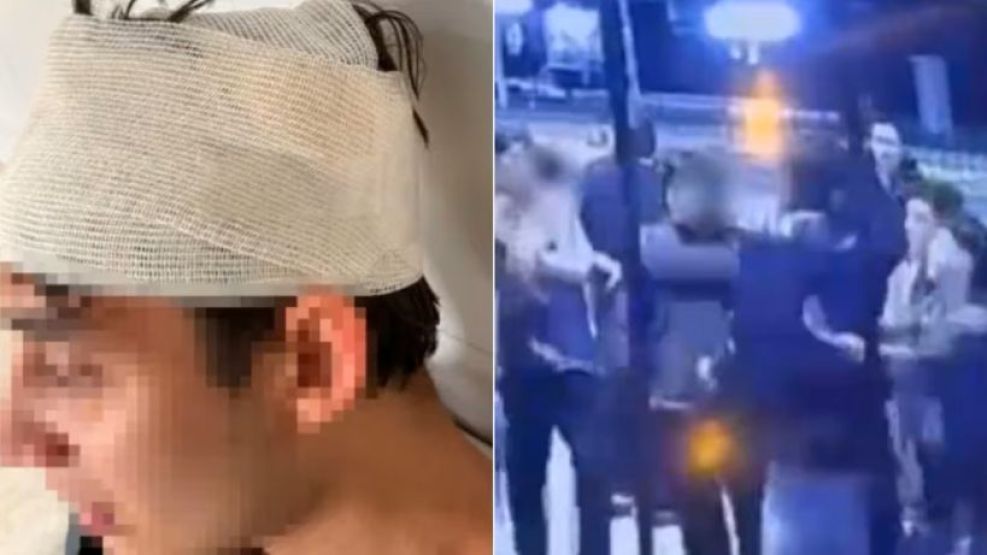 21-11-2025 joven mendocino golpeado por rugbiers cordobeses